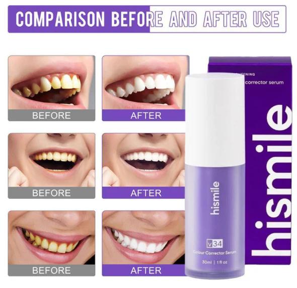 Hismile - Teeth Brightening Serum V34 (Original)